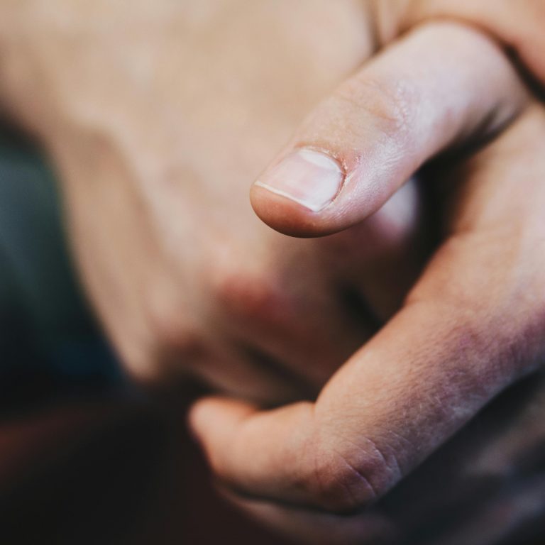 The secret to maintaining healthy skin while managing blood glucose